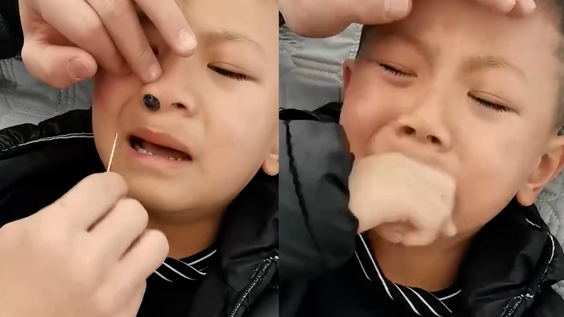 6岁男童不慎将玻璃珠卡进鼻孔，爸爸：越掏越痛，最后挤出来了