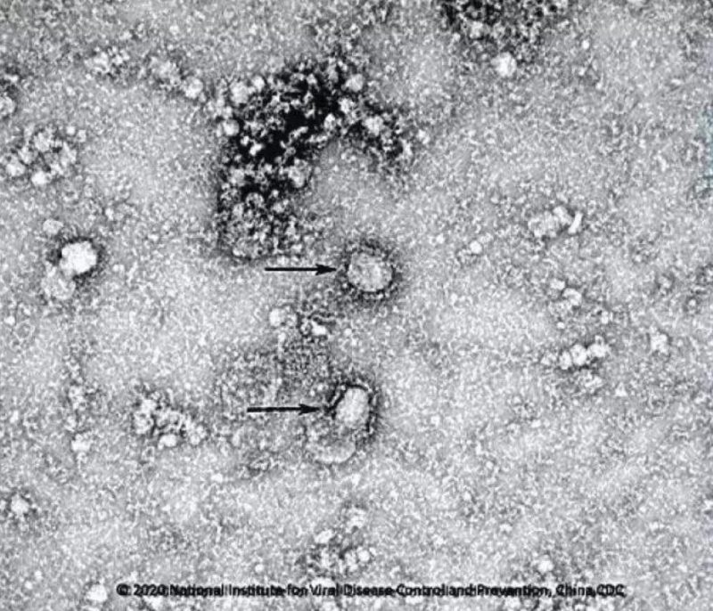 ▲新型冠状病毒武汉株01。照片来源：国家病原微生物资源库（中国疾病预防控制中心病毒病预防控制所）